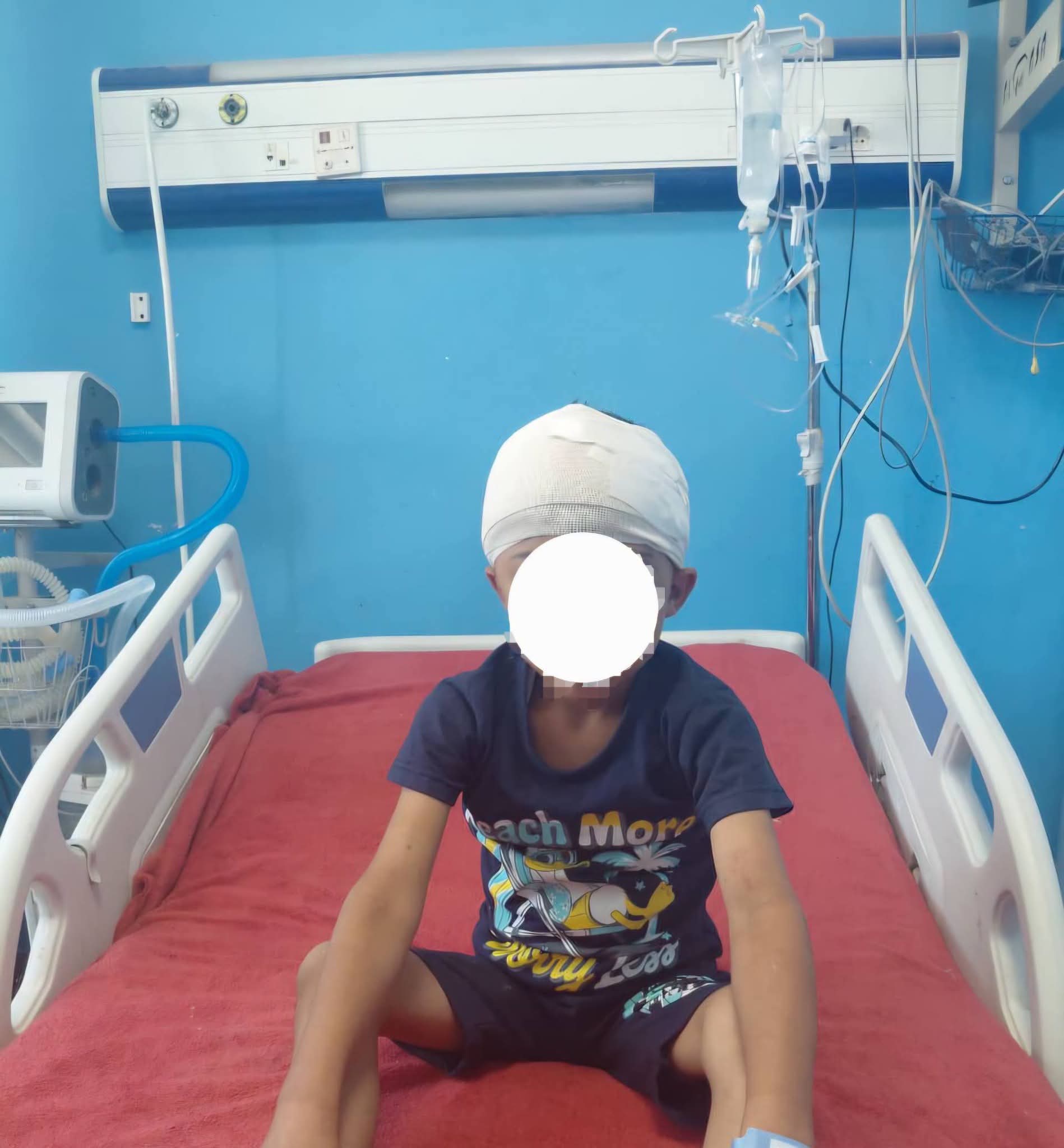 معجزة طبية بمستشفيات سوهاج الجامعية .. استخراج رصاصة طائشه من مخ طفل